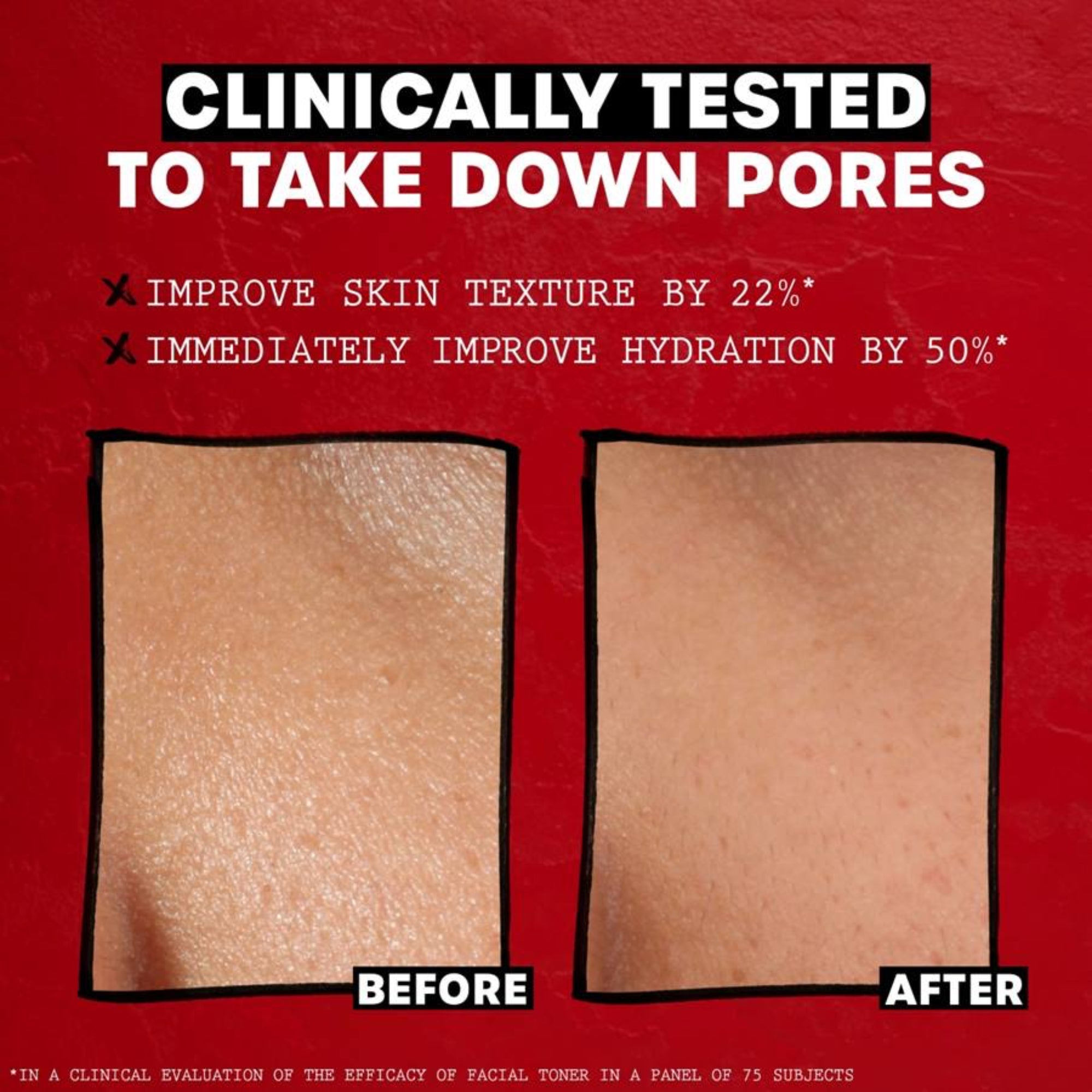 Thayers Alcohol-Free Rose Petal Witch Hazel Facial Toner, 12 fl oz, 355 ml